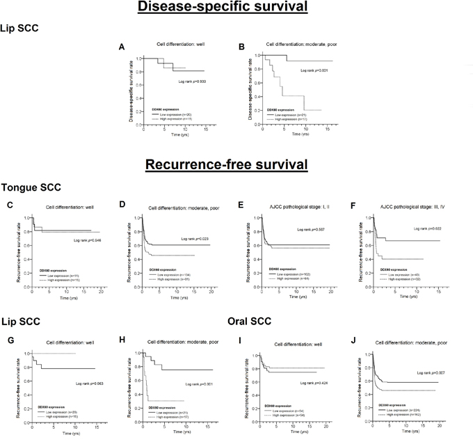 Differences in the survival curves between patients with high and low levels of DDX60 expression in LSCC (A, B for DSS; G, H for RFS), TSCC (C-F for RFS), and OSCC (I, J for RFS), stratified according to cell differentiation and the pathological stage.