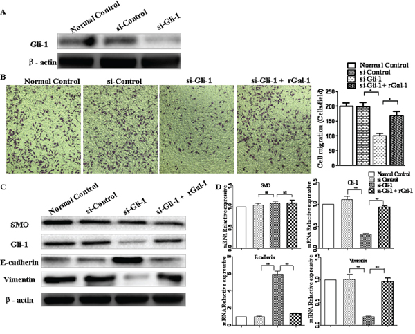 Gli-1 siRNA abolishes Gal-1-mediated invasion and EMT in gastric cancer cells.