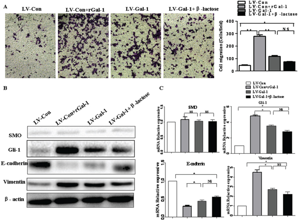 The effects of &#x03B2;-lactose on Gal-1-induced gastric cancer cell invasion and the EMT.