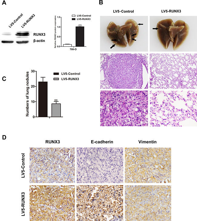 RUNX3 suppressed RCC metastasis in vivo.