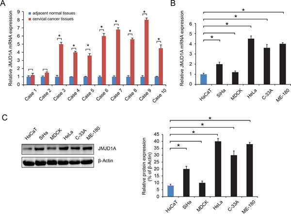 JMJD1A expression level is significantly upregulated in cervical cancer.