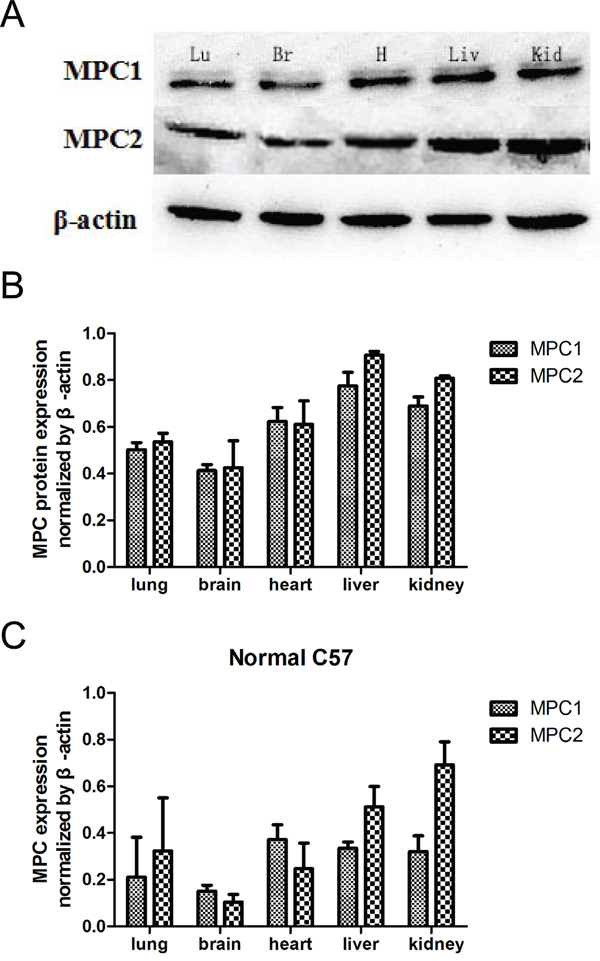 MPC1 and MPC2 expressions in multiple organs and Western blotting results.