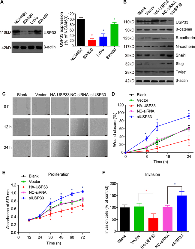 USP33 inhibits cell proliferation, migration, and invasion.