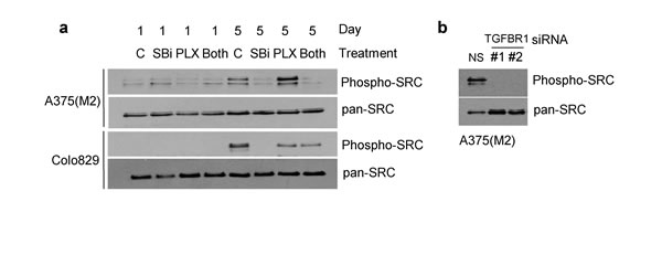 SB-431542 treatment and TGFBR1 knockdown inhibit phosphorylation of SRC.