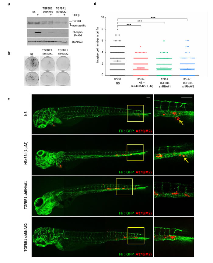 TGFBR1 is required for tumour cell metastasis in xenografted zebrafish.