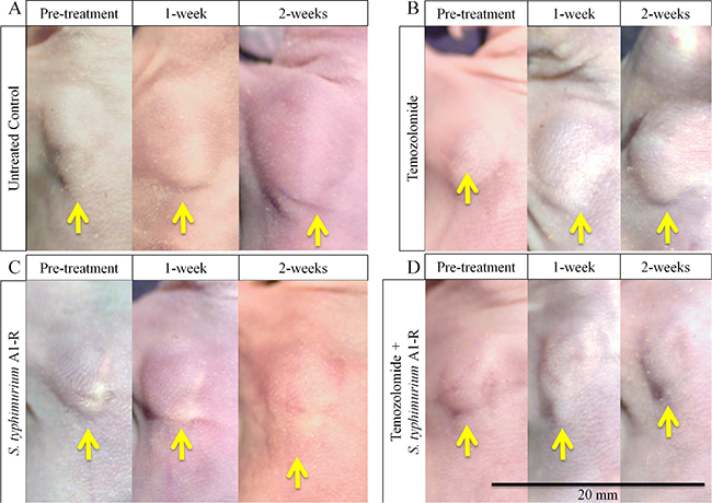 Macroscopic demonstration of therapeutic efficacy of TEM and S. typhimurium A1-R on a melanoma PDOX.