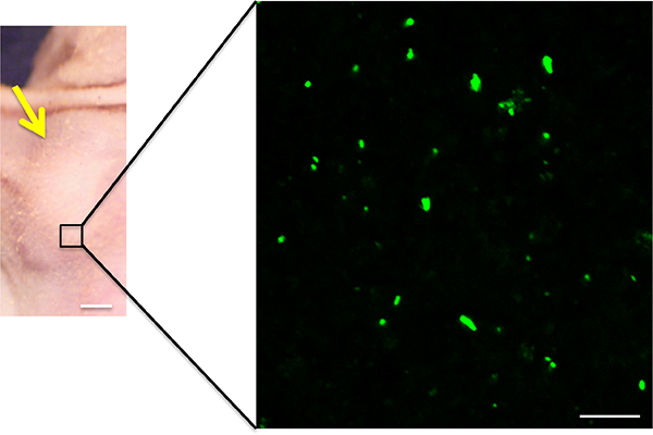 Fluorescence imaging of S. typhimurium A1-R-GFP targeting the melanoma PDOX.