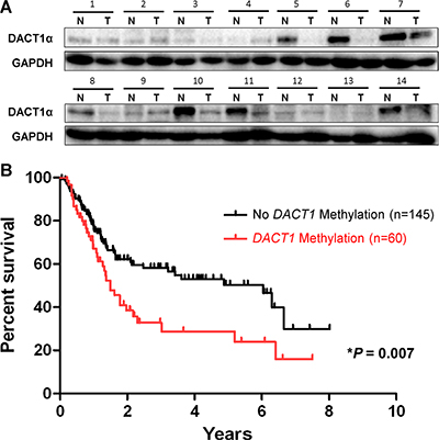 Kaplan-Meier survival curves show that gastric cancer patients with DACT1&#x03B1; methylation had poorer survival than those without DACT1&#x03B1; methylation.