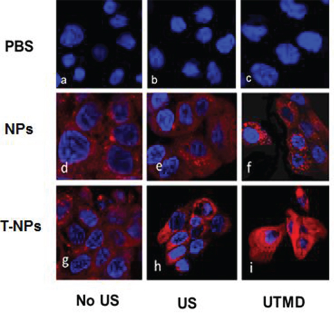 CLSM images of AFPC-1 cells after a 2 h incubation with the nanoparticles (NPs) with US or UTMD.