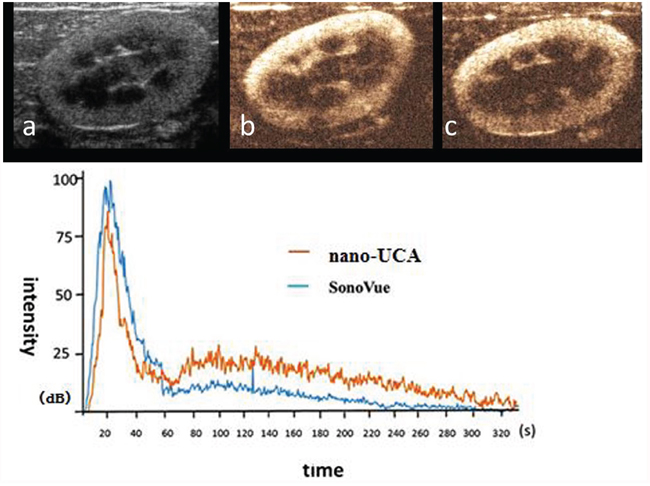 Two-dimensional ultrasonic imaging and ultrasound contrast enhanced imaging of UCAs in rabbit kidney and the time vs. intensity curve.