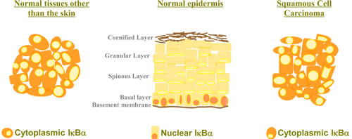 Cytoplasmic localization of IκBα in the skin is associated with tumorigenesis. IκBα is localized in the cytoplasm of most cell types where it plays a major role as a negative regulator of the NF-κB signaling pathway. However, IκBα is detected in the nucleus of basal layer keratinocytes, whereas loss of nuclear IκBα and its cytoplasmic accumulation is a hallmark of human Squamous Cell Carcinoma.