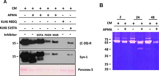 A metalloproteinase mediates &#x03B1;-synuclein degradation.