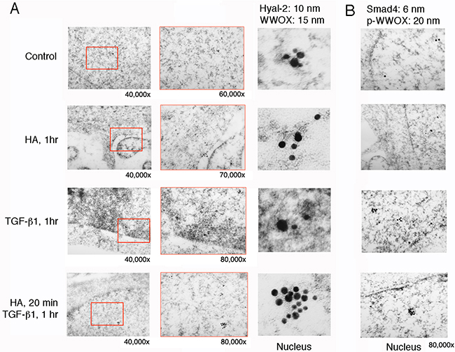 Immunoelectron microscopy analysis for HA induction of WWOX/Hyal-2 nuclear translocation.