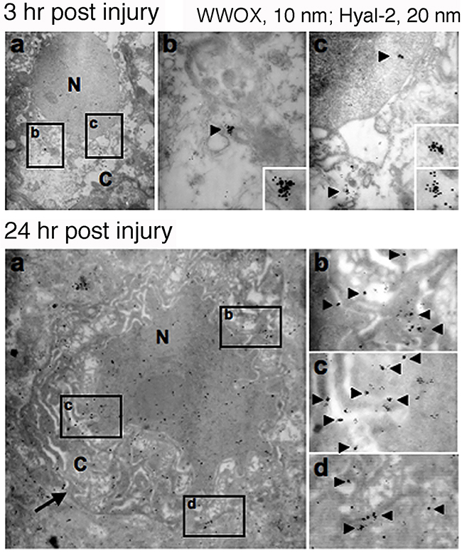 Nuclear accumulation of Hyal-2 and WWOX in apoptotic nuclei of cortical neurons during traumatic brain injury.