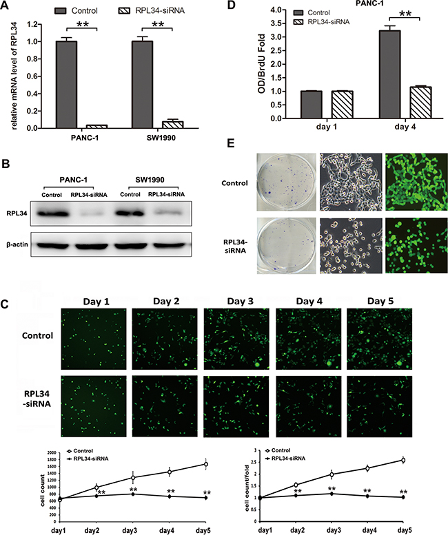 Knockdown of RPL34 inhibits cell growth and proliferation.