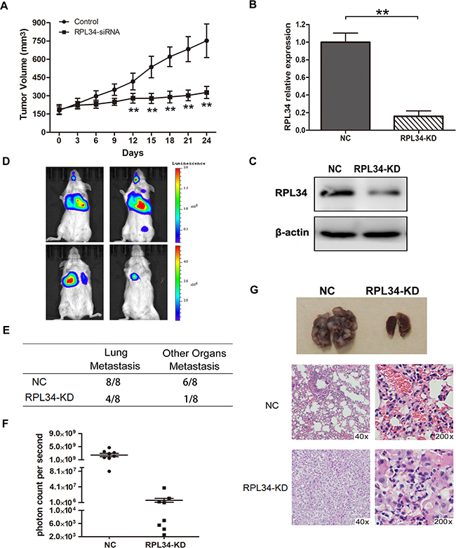 Knockdown of RPL34 in PANC-1 cells suppresses tumor growth and lung metastasis in vivo.