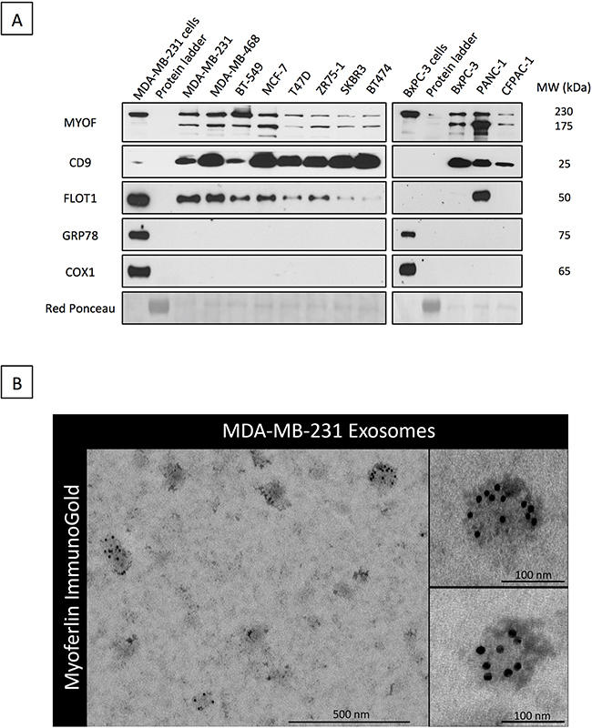Myoferlin is expressed in exosomes from breast and pancreas cancer cell lines.