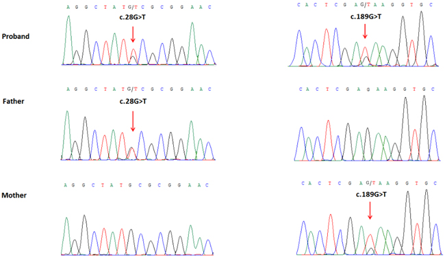 Partial DNA sequences in the WDR62 by Sanger sequencing of the family.