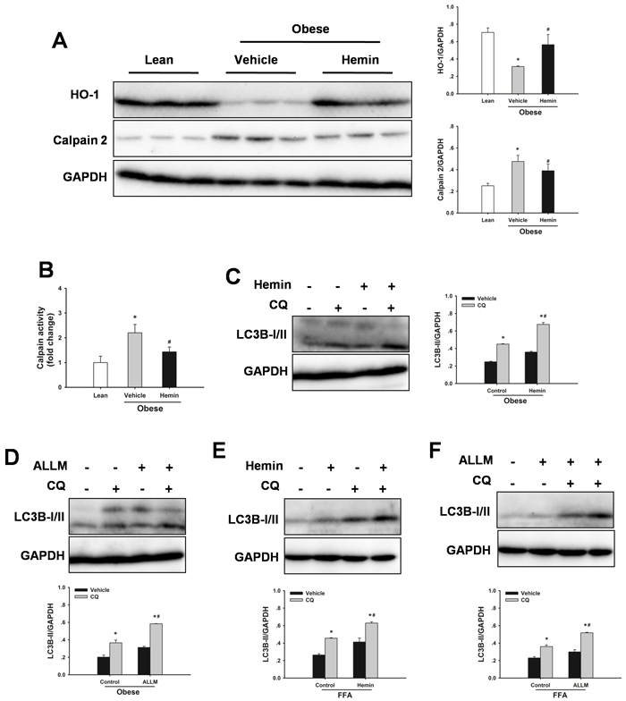 Defective autophagy is mediated by HO-1/calpain 2 signaling.