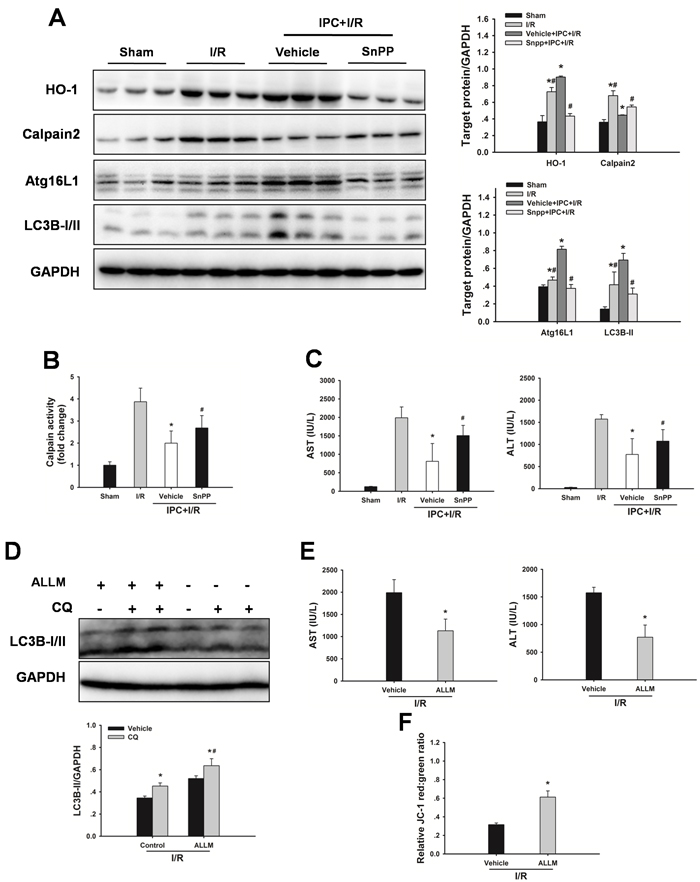 Inhibition of HO-1 by SnPP attenuates the IPC-induced hepatoprotection.