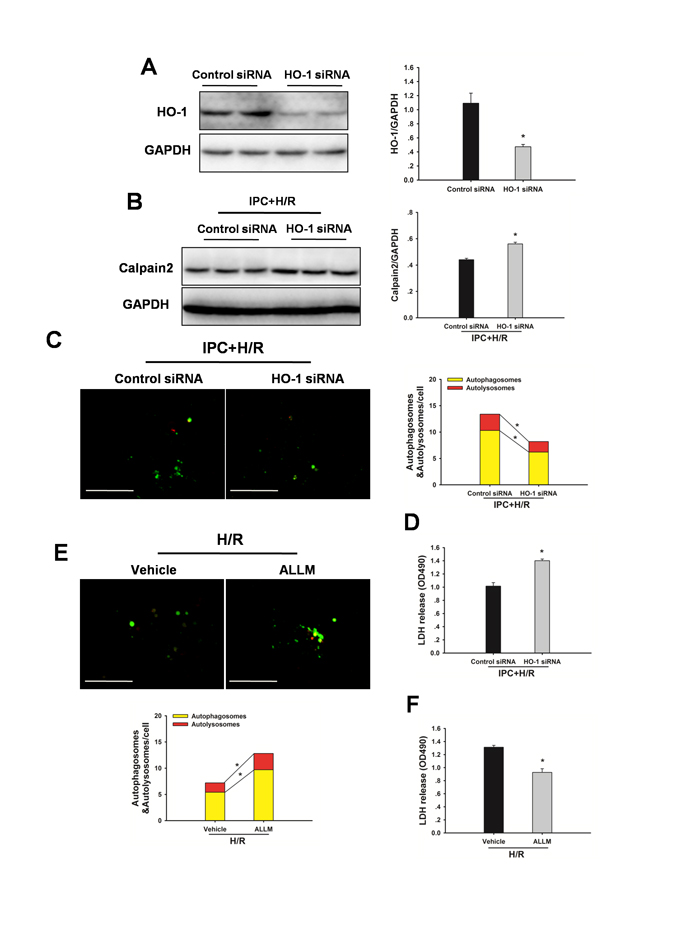 Inhibition of HO-1 by HO-1 siRNA attenuates the IPC-induced hepatoprotection in vitro.
