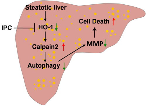 Scheme of possible protective mechanism of IPC on steatotic liver I/R injury.