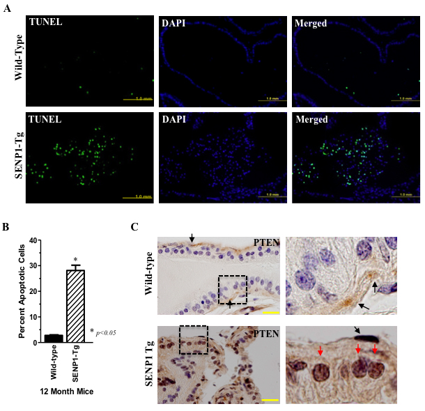 SENP1-Tg mice exhibit elevated prostate epithelial cells apoptosis and PTEN expression.