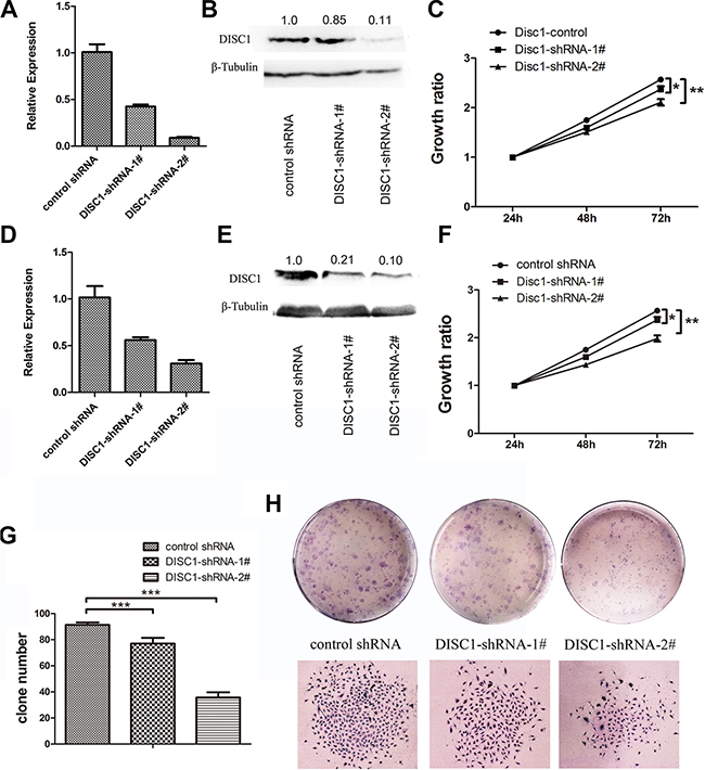 Reduced DISC1 inhibits glioblastoma cell proliferation in vitro and in vivo.