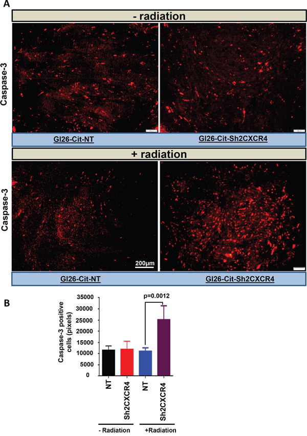 CXCR4&#x2013;deficient glioma cells were more sensitive to radiation mediated cell death.