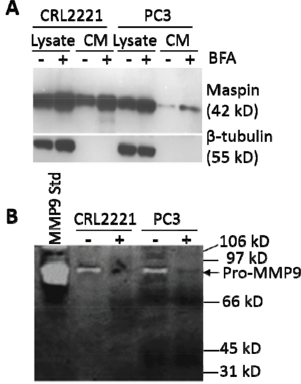 Soluble maspin is secreted by a non-classical secretory pathway.