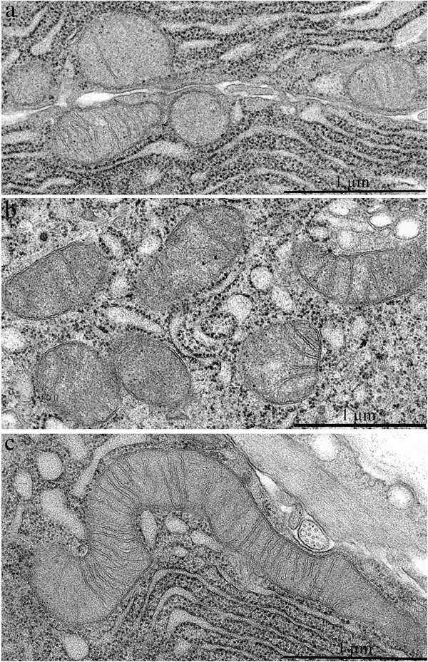 Mitochondrial ultrastructure in acinar cells in the lacrimal gland of Wistar rats.