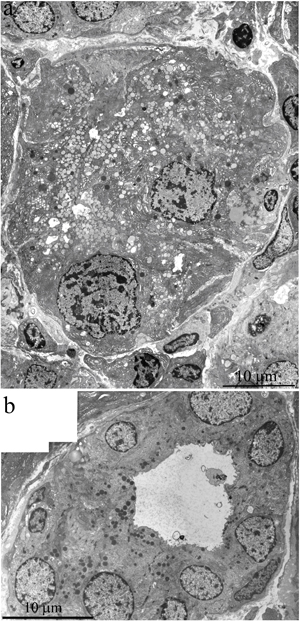 Ultrastructure of the lacrimal gland of a 24-month-old Wistar rat that received the antioxidant SkQ1 starting at age 1.5 months at the dose 250 nmol/(kg body weight) daily.
