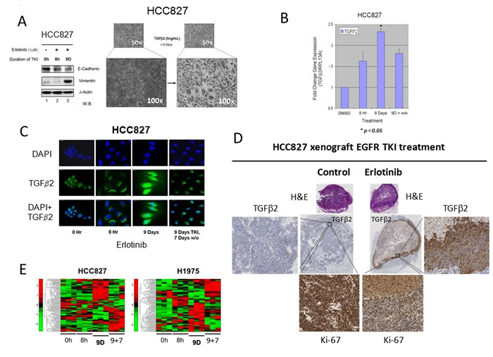 Autocrine TGF&#x3b2;2 upregulation in lung adenocarcinoma early adaptive drug-escape correlated with EMT and stem cell signaling reprogramming.