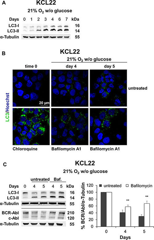 Role of autophagy in BCR/Abl protein suppression under glucose shortage.