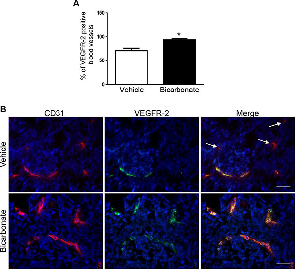 Sodium bicarbonate increases the percentage of VEGFR-2 positive blood vessels in HT29 tumor xenografts.