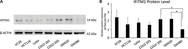 Evaluation of IFITM1 expression in various colorectal carcinoma cell lines by western blot.