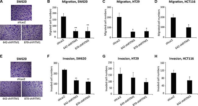 IFITM1 depletion impairs migration and invasion of colorectal cancer cell lines in vitro.