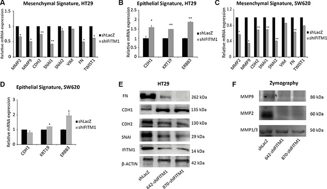 IFITM1 is required for the maintenance of EMT signature.