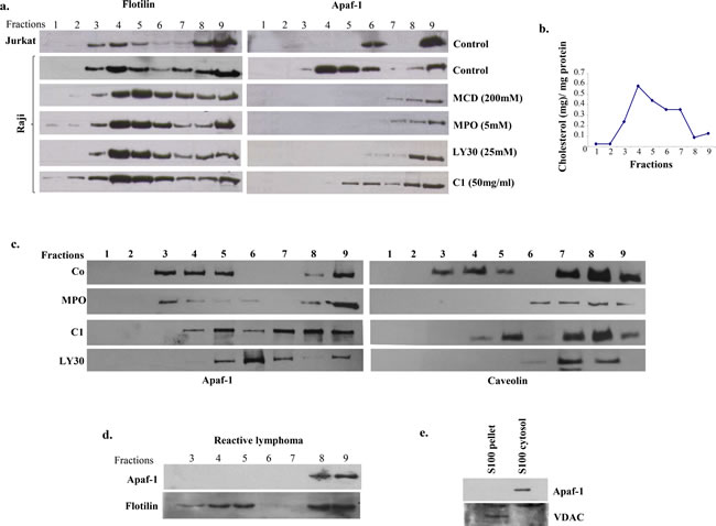 Apaf-1 is sequestered in the lipid raft fractions of Raji cells and primary BL cells.