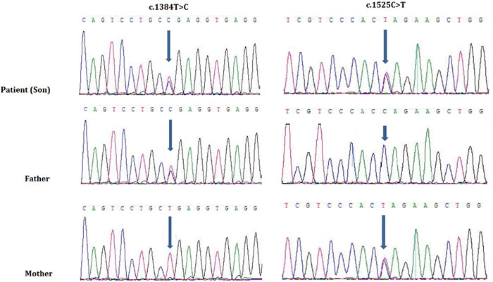 Sanger sequencing of