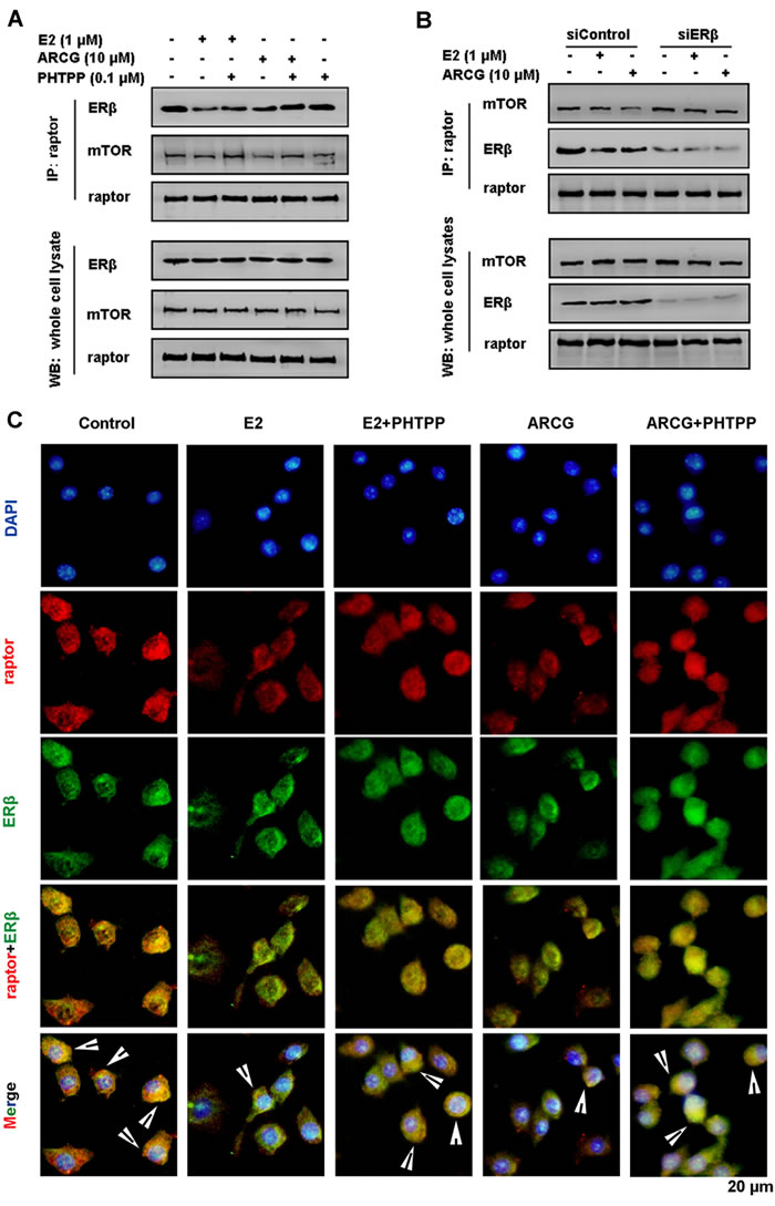 Arctigenin interferences with the formation of ER&#x3b2;-raptor-mTOR complex in T cells.