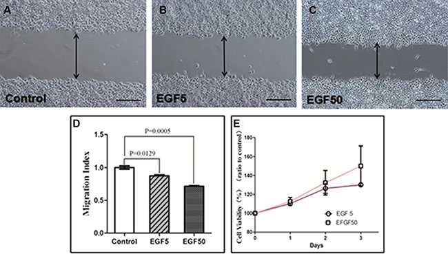 Wounding assay in EGF-treated Ishikawa cells.