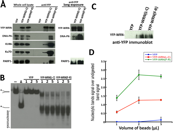 Immunoprecipitation of eYFP-WRN variants in WS fibroblasts (AG11395B) and evaluation of WRN exonluclease activity.