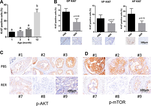 RER inhibited tumor cell proliferation and Akt pathway.