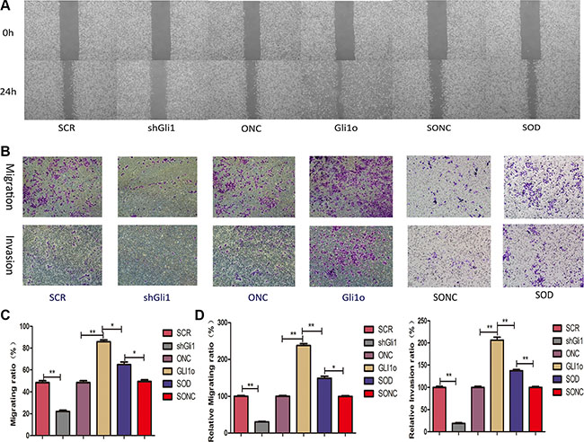 Gli1 promotes colorectal cancer cells migration and invasion in a Foxm1-dependent manner