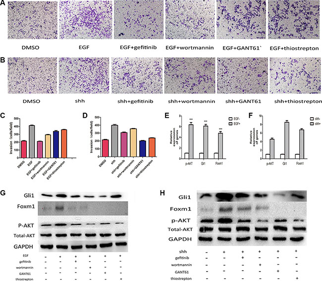 Integration of Gli1-Foxm1 axis and EGFR-PI3K/AKT signaling enhance colorectal metastasis.