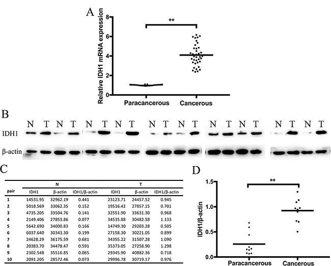 IDH1 expression in cancerous tissue compared with that in paracancerous tissue was detected at (A) mRNA level by RT&#x2013;PCR.