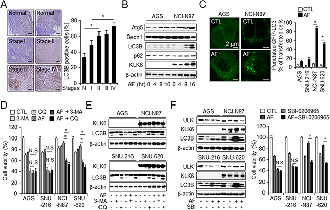 KLK6 expression decreases in AF-induced cell death via the activation of autophagy in gastric cancer.