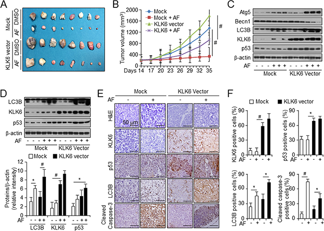 KLK6 overexpression with AF treatment decreases therapeutic effects on xenograft tumor growth in vivo.