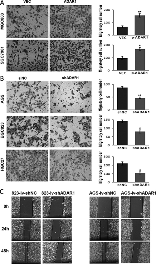 ADAR1 promotes GC cell motility.